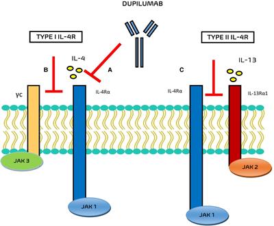 Severe pediatric asthma therapy: Dupilumab